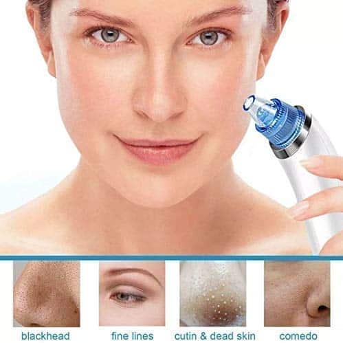 Beautiful Skin Care Expert Acne Pore Cleaner Vacuum Blackhead Remover Kit