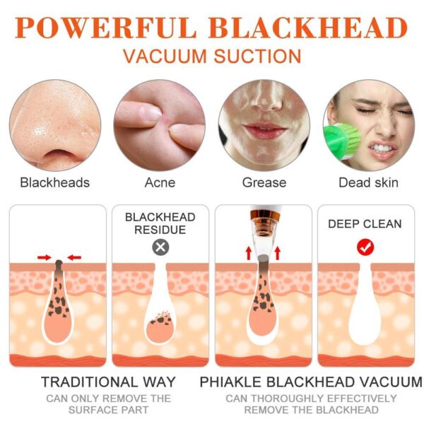 Blackhead Remover Chargeable Vacuum Machine