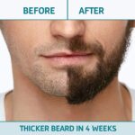 Beard Growth Kit with Onion Beard Growth Oil for Men